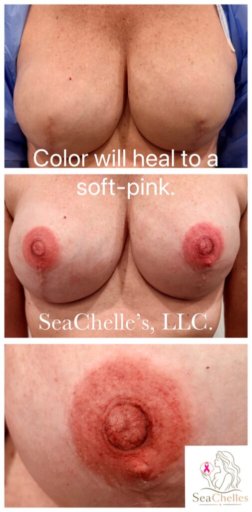 Before and fresh areola tattooing results